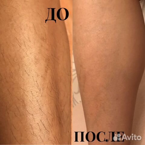 Шугаринг и воск Шугаринг и воск