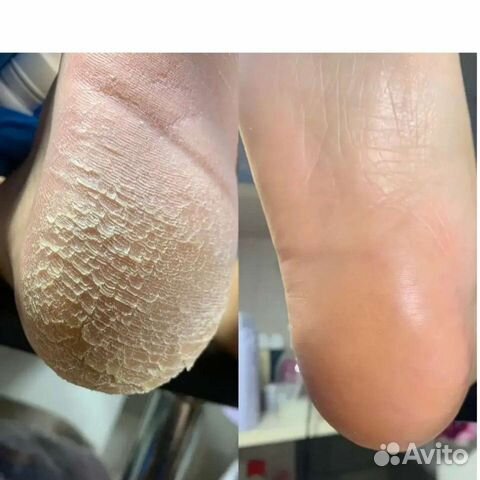 Педикюр мужской, женский, маникюр