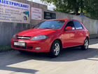 Chevrolet Lacetti 1.6 МТ, 2008, 170 182 км